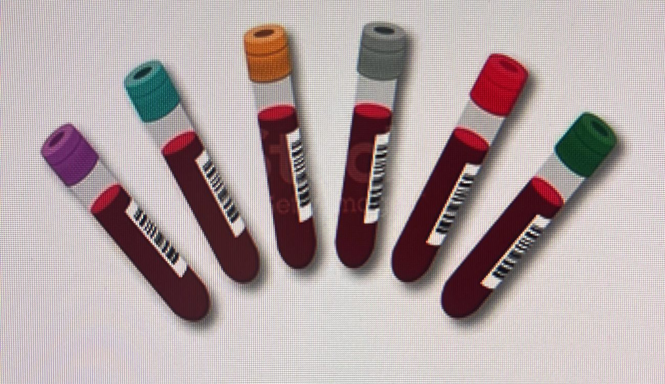 Phlebotomy Diagnosticlabs Blood Sample